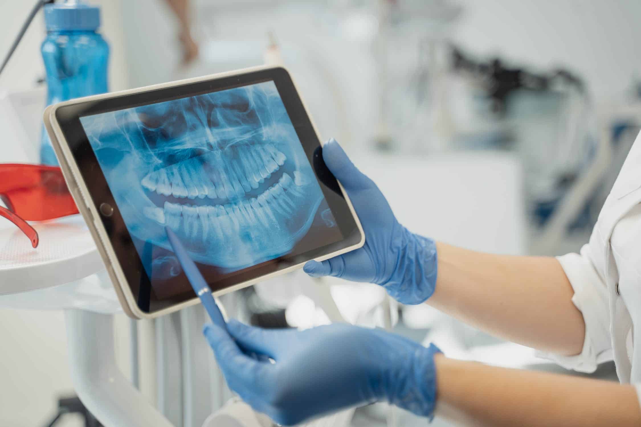 SEO for dentists dental scan